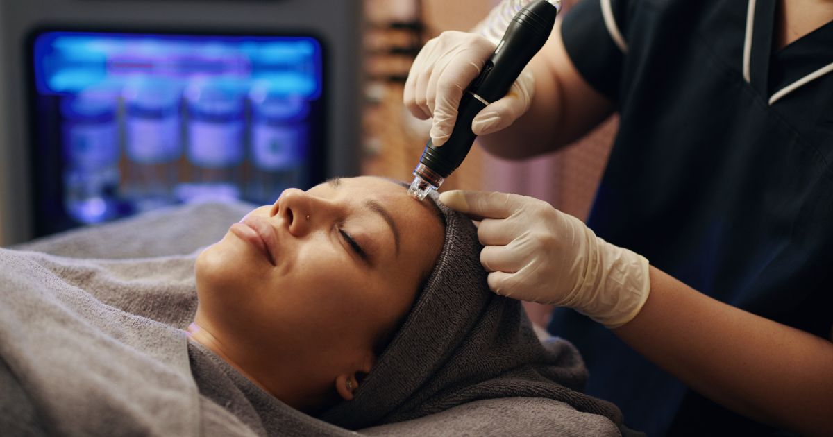 The microneedling treatment process at Fond & Faye, designed to safely trigger the skin's natural repair system.