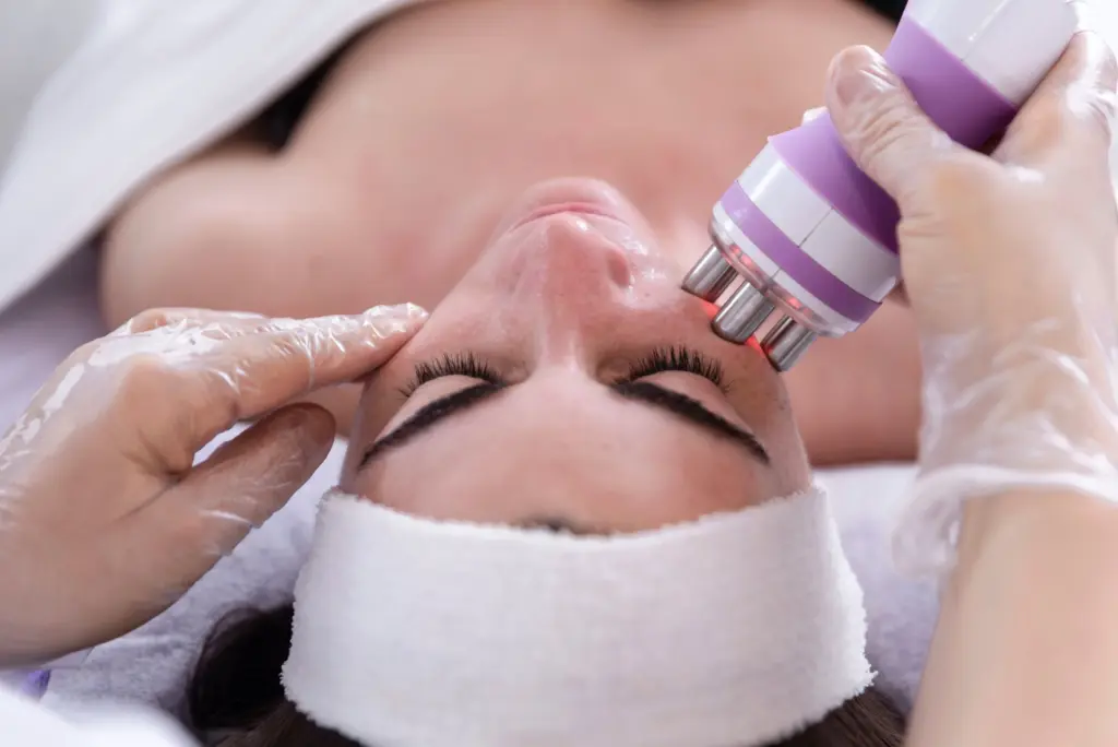 Facial Radiofrequency - Fond and Faye