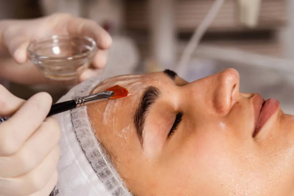 Resurface & Renew Peel Facial in Rutherford, NJ