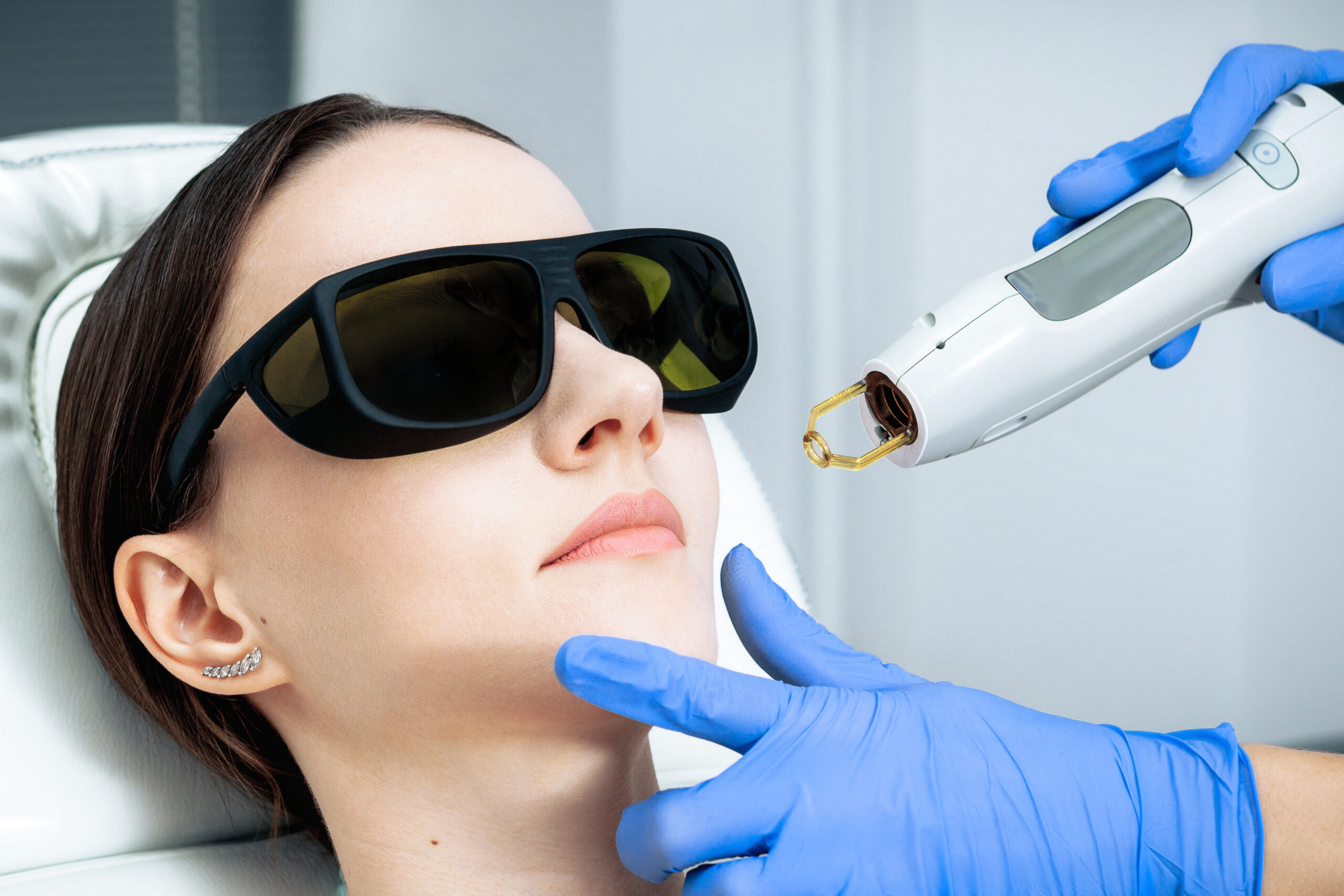 IPL for dark spots Rutherford NJ