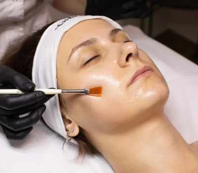 Express Glow Peel in Rutherford, NJ Express Glow Peel in Rutherford, NJ